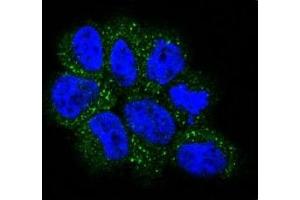 Confocal immunofluorescent analysis of NRAS antibody with NCI-H460 cells followed by Alexa Fluor 488-conjugated goat anti-rabbit lgG (green).
