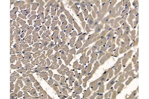 ABIN7097074 and ABIN7101141 at 1/100 staining rat heart tissue by IHC-P.