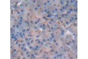 IHC-P analysis of Human Tissue, with DAB staining. (STATH anticorps  (AA 1-62))