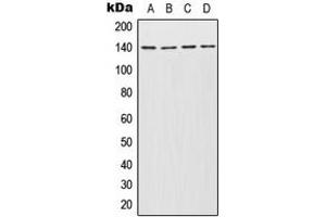 Western blot analysis of INCENP expression in Jurkat (A), Molt4 (B), SP2/0 (C), PC12 (D) whole cell lysates. (INCENP anticorps  (Center))