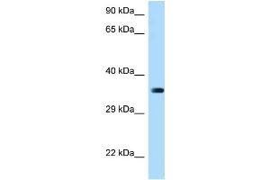 WB Suggested Anti-March2 Antibody Titration: 1. (MARCH2 anticorps  (Middle Region))