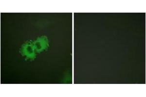 Immunofluorescence analysis of HeLa cells, using Caldesmon (Phospho-Ser789) Antibody.