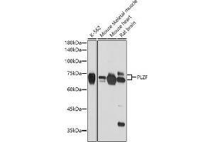 Western blot analysis of extracts of various cell lines, using PLZF antibody (ABIN6128472, ABIN6150368, ABIN6150369 and ABIN6221570) at 1:2654 dilution. (ZBTB16 anticorps  (AA 1-220))