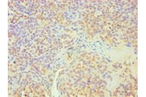 Immunohistochemistry of paraffin-embedded human tonsil tissue using ABIN7164363 at dilution of 1:100