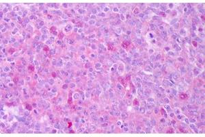 Anti-CD40LG / CD54 antibody IHC staining of human tonsil.