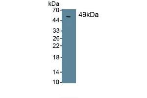 Detection of Recombinant SPC, Human using Monoclonal Antibody to Surfactant Protein C (SP-C) (Surfactant Protein C anticorps  (AA 24-197))