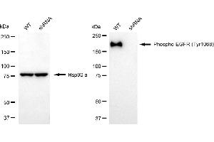Western blotting analysis using phospho-EGFR (Tyr) antibody (ABIN7798464).