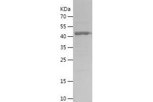 Western Blotting (WB) image for ATG7 Autophagy Related 7 (ATG7) (AA 410-619) protein (His-IF2DI Tag) (ABIN7121923)