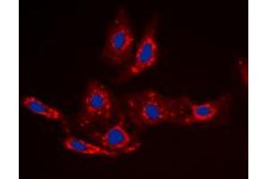 Immunofluorescent analysis of Beta-catenin (pS33) staining in HepG2 cells. (beta Catenin anticorps  (N-Term, pSer33))