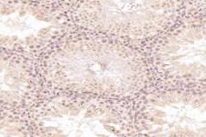 Immunohistochemistry analysis of paraffin-embedded rat testis using,MED3 (ABIN7074581) at dilution of 1: 7200 (MED27 anticorps)