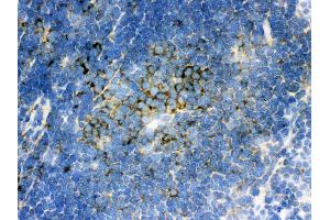 Anti- SQSTM1 Picoband antibody,IHC(F) IHC(F): Mouse Spleen Tissue