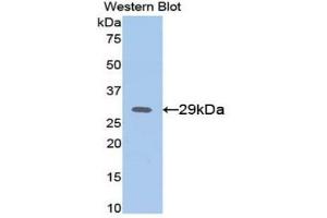 Detection of Recombinant AFP, Mouse using Polyclonal Antibody to Alpha-Fetoprotein (AFP) (alpha Fetoprotein anticorps  (AA 399-605))
