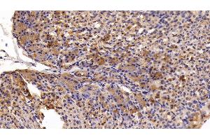 Detection of MASP1 in Mouse Stomach Tissue using Polyclonal Antibody to Mannose Associated Serine Protease 1 (MASP1) (MASP1 anticorps  (AA 25-453))