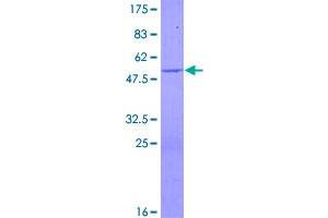 Image no. 1 for Crystallin, beta A4 (CRYbA4) (AA 1-196) protein (GST tag) (ABIN1350434)