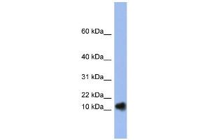 WB Suggested Anti-RNASE1 Antibody Titration:  0. (RNASE1 anticorps  (N-Term))