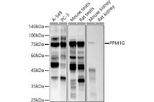 Western blot analysis of extracts of various cell lines, using PPM1G antibody (ABIN7269696) at 1:500 dilution. (PPM1G anticorps)