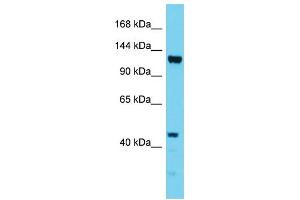 Host: Rabbit Target Name: EFTUD1 Sample Type: HepG2 Whole Cell lysates Antibody Dilution: 1. (EFTUD1 anticorps  (N-Term))