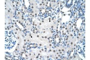 YWHAQ antibody was used for immunohistochemistry at a concentration of 4-8 ug/ml to stain Epithelial cells of renal tubule (arrows) in Human Kidney. (14-3-3 theta anticorps  (N-Term))