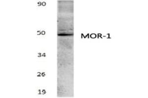 Image no. 1 for anti-Opioid Receptor, mu 1 (OPRM1) antibody (ABIN317766) (Mu Opioid Receptor 1 anticorps)