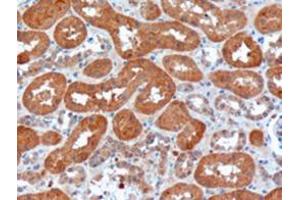 Image no. 2 for anti-Usher Syndrome 1C (Autosomal Recessive, Severe) (USH1C) (N-Term) antibody (ABIN374408) (USH1C anticorps  (N-Term))