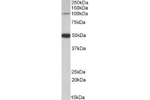 Western Blotting (WB) image for anti-Patched Domain Containing 1 (PTCHD1) antibody (ABIN5937394) (PTCHD1 anticorps)