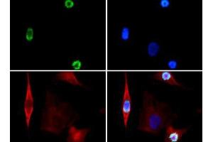 Immunofluorescence of Rabbit Anti-Histone H3 [p Ser28] Antibody. (Histone 3 anticorps  (pSer28))
