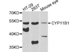 Western blot analysis of extracts of various cells, using CYP11B1 antibody. (CYP11B1 anticorps)