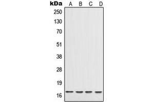 Western blot analysis of IL-17 expression in A20 (A), THP1 (B), Raw264. (IL-17 anticorps  (Center))