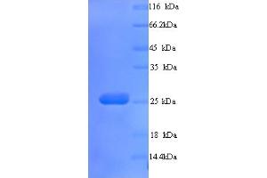 SDS-PAGE (SDS) image for butyrophilin, Subfamily 3, Member A3 (BTN3A3) (AA 30-248) protein (His tag) (ABIN5713292)