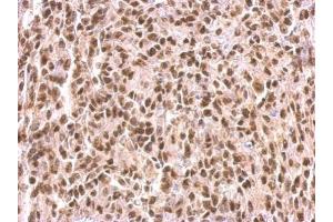 IHC-P Image MEF2C antibody detects MEF2C protein at nucleus on Saos2 xenograft by immunohistochemical analysis.