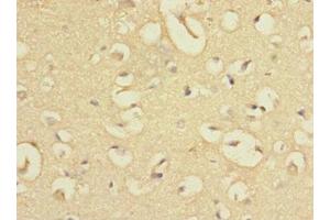 Immunohistochemistry of paraffin-embedded human brain tissue using ABIN7165334 at dilution of 1:100 (EVI2A anticorps  (AA 31-133))