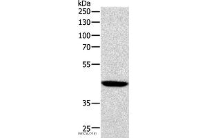 Western blot analysis of Human lymphoma tissue, using SOX7 Polyclonal Antibody at dilution of 1:1100 (SOX7 anticorps)