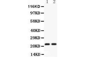 Anti-CD3 epsilon Picoband antibody,  All lanes: Anti CD3 Epsilon  at 0.