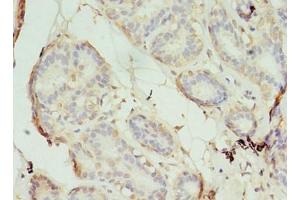Immunohistochemistry of paraffin-embedded human breast cancer using ABIN7170565 at dilution of 1:100