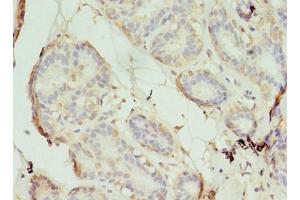 Immunohistochemistry of paraffin-embedded human breast cancer using ABIN7170565 at dilution of 1:100 (S1PR1 anticorps  (AA 311-382))