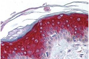 Human Skin (formalin-fixed, paraffin-embedded) stained with RPS6KA1 antibody ABIN213975 at 5 ug/ml followed by biotinylated goat anti-rabbit IgG secondary antibody ABIN481713, alkaline phosphatase-streptavidin and chromogen. (RPS6KA1 anticorps  (N-Term))