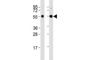 Western blot testing of Beclin-1 antibody at 1:2000 dilution.