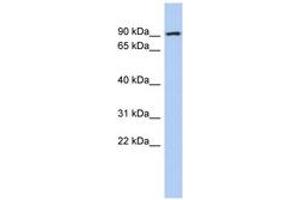Image no. 1 for anti-Aldehyde Dehydrogenase 18 Family, Member A1 (ALDH18A1) (AA 35-84) antibody (ABIN6744012) (P5CS anticorps  (AA 35-84))