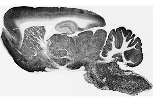 Adult rat brain immunohistochemistry.