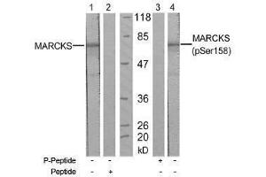 Image no. 1 for anti-Myristoylated Alanine-Rich Protein Kinase C Substrate (MARCKS) (pSer158) antibody (ABIN197065) (MARCKS anticorps  (pSer158))