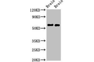 Western Blot Positive WB detected in: Mouse brain tissue, Rat brain tissue All lanes: GAS7 antibody at 2. (GAS7 anticorps  (AA 1-153))