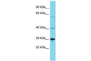 Host: Rabbit Target Name: KIAA1919 Sample Type: Hela Whole Cell lysates Antibody Dilution: 1. (KIAA1919 anticorps  (Middle Region))