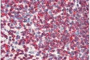 anti-WD Repeat and HMG-Box DNA Binding Protein 1 (WDHD1) (C-Term) antibody