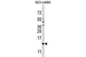 SMCP Antibody (C-term) western blot analysis in NCI-H460 cell line lysates (35µg/lane). (SMCP anticorps  (C-Term))