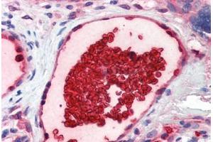 Human Placenta, Vessel with Erythrocytes (formalin-fixed, paraffin-embedded) stained with GYPA antibody ABIN337240 at 5 ug/ml followed by biotinylated goat anti-rabbit IgG secondary antibody ABIN481713, alkaline phosphatase-streptavidin and chromogen.