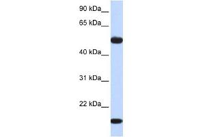 ADSSL1 antibody used at 1 ug/ml to detect target protein.