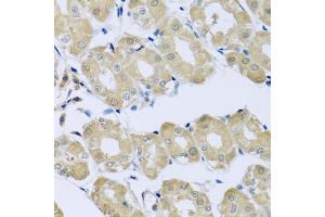 Immunohistochemistry of paraffin-embedded human stomach using SYT4 antibody (ABIN5975174) at dilution of 1/100 (40x lens). (SYT4 anticorps)