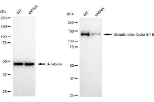 Western blotting analysis using Ubiquitination factor E4 B antibody (ABIN7800713).
