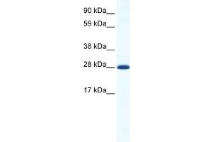 WB Suggested Anti-DLX4 Antibody Titration:  1. (DLX4 anticorps  (N-Term))