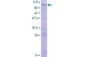 Image no. 1 for NFKB Repressing Factor (NKRF) (AA 1-690) protein (GST tag) (ABIN1312614)